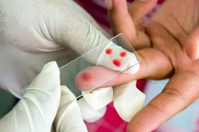 Diagnose von Schmerzen in den Fingern Gelenke