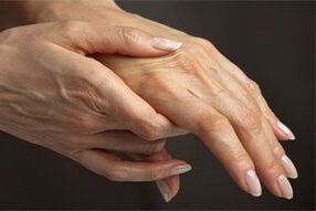 Weil die Gelenke der Finger weh tun