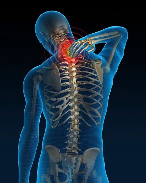 In der Anfangsphase der Behandlung der zervikalen Osteochondrose nehmen die Nackenschmerzen zu